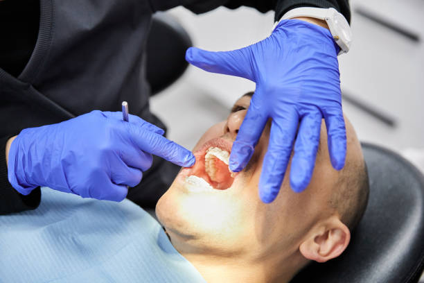 Best Emergency Gum Treatment in Elkhart, KS